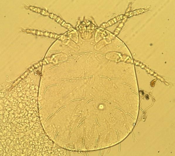 This photo, released Friday by the Korea Disease Control and Prevention Agency, shows a trombiculid mite, a carrier of scrub typhus.   